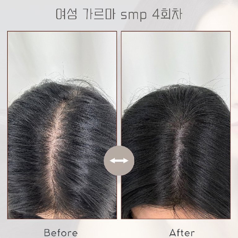팔로우픽 - followPick 