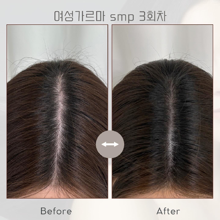 팔로우픽 - followPick 