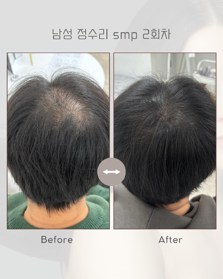 팔로우픽 - followPick 