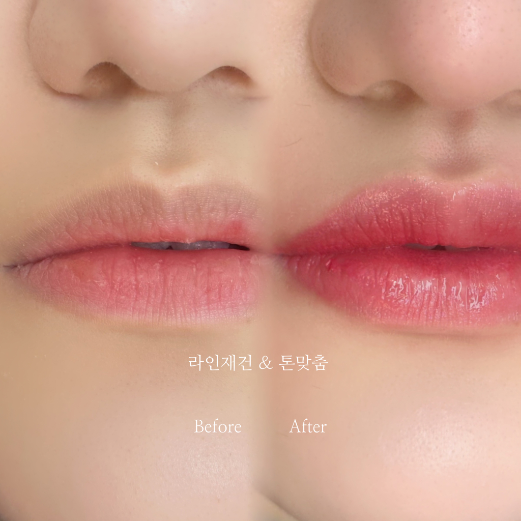 팔로우픽 - followPick 