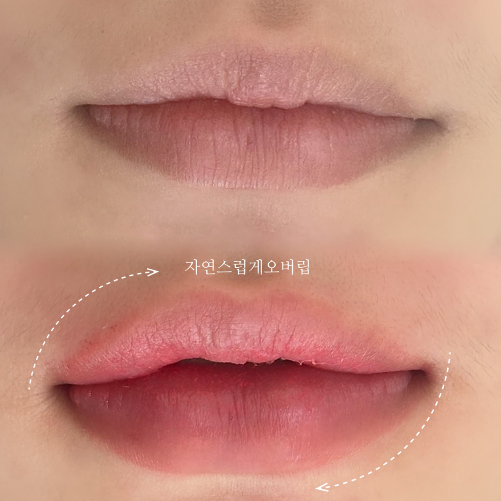팔로우픽 - followPick 