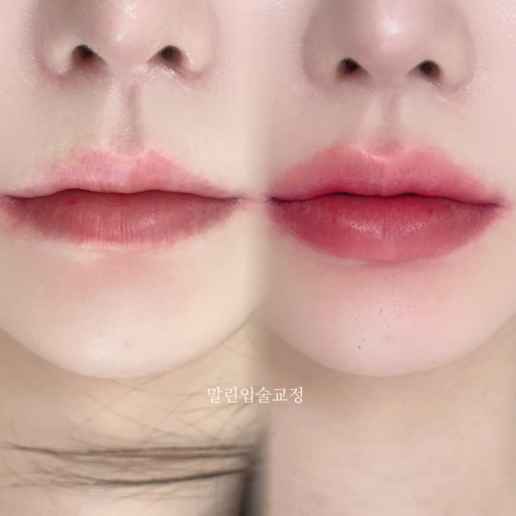 팔로우픽 - followPick | 수원 무료 입술시술 포스팅해주실분모집합니다.