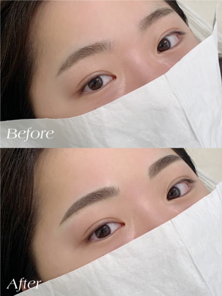 팔로우픽 - followPick 