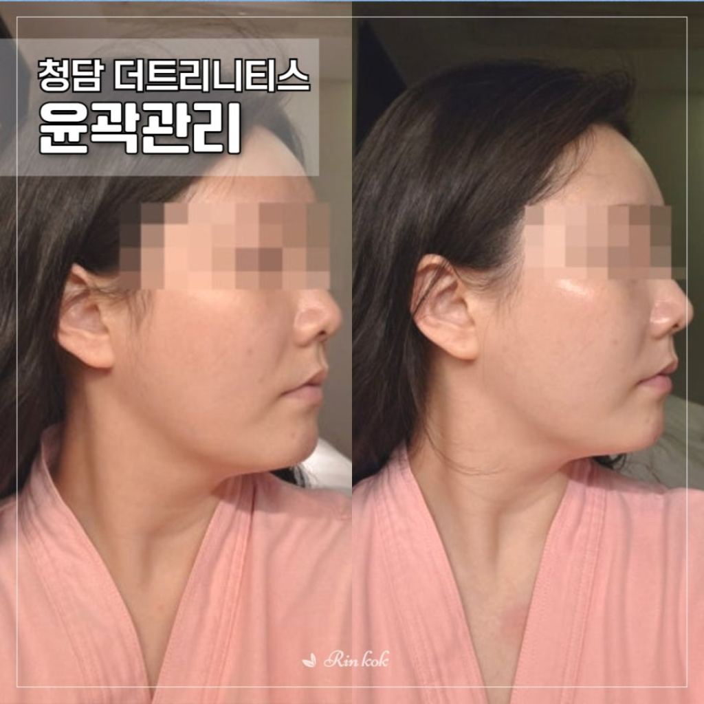팔로우픽 - followPick 