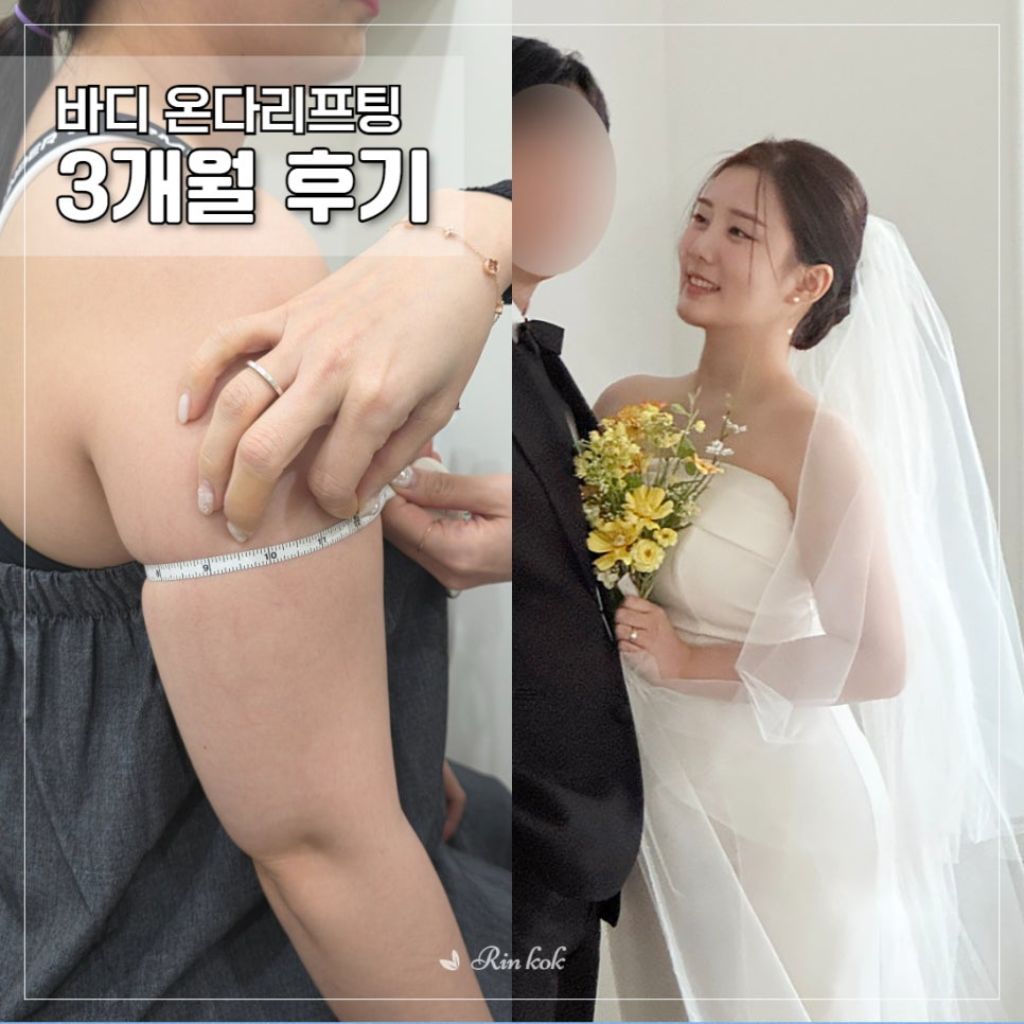 팔로우픽 - followPick | 피부과 의료 키워드 상위노출
