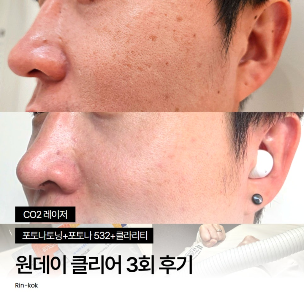 팔로우픽 - followPick 