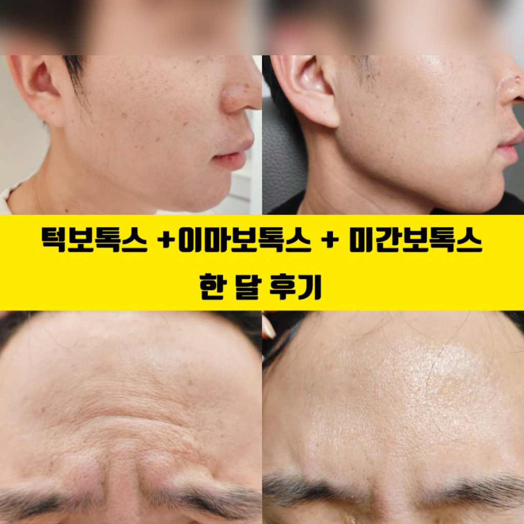 팔로우픽 - followPick 